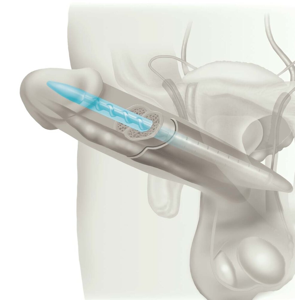 Genesis Bükülebilir Penil Protez
